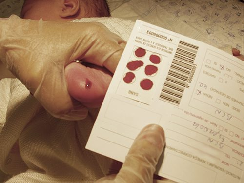 Cribado neonatal. Imagen: Gencat - Generalitat de Catalunya