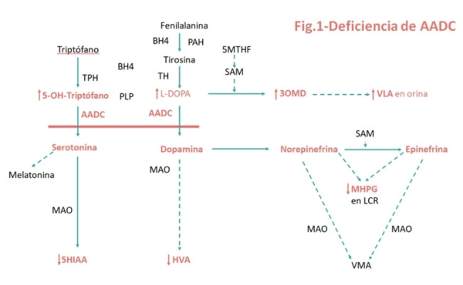 Deficiencia de la descarboxilasa de los L-aminoácidos aromáticos (AADC)