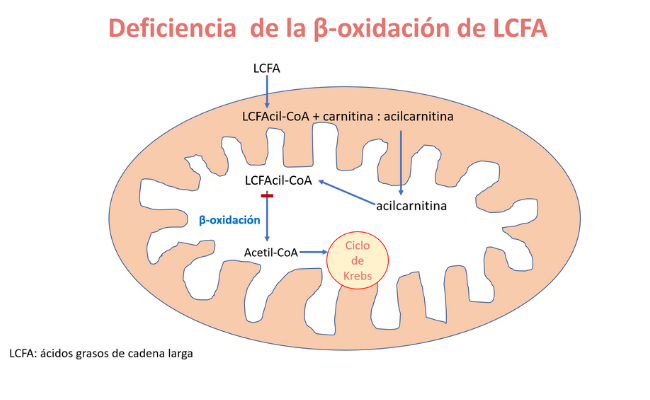 Defectos de la β-oxidación de los ácidos grasos de cadena larga (LCFAOD)