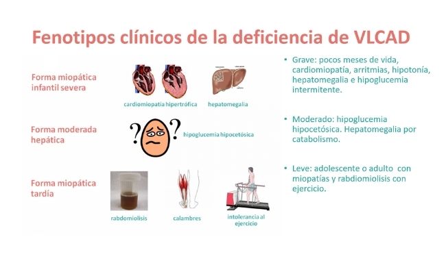 Fenotipos clínicos de la deficiencia de VLCAD