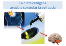 La dieta cetógena ayuda a prevenir la epilepsia