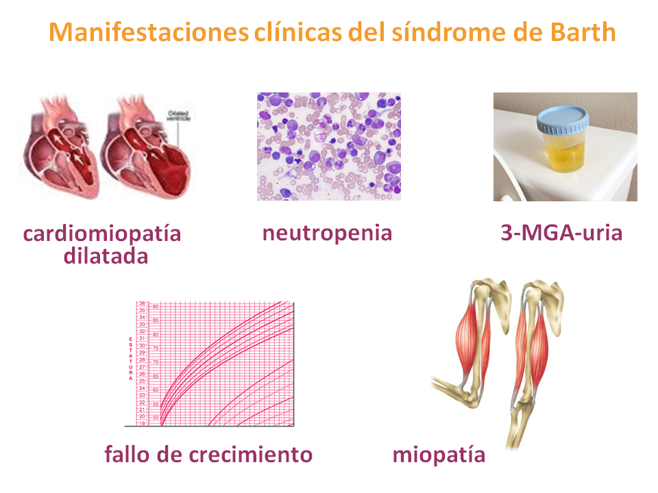 Manifestaciones clínicas del síndrome de Bart. Imagen: HSJDBCN