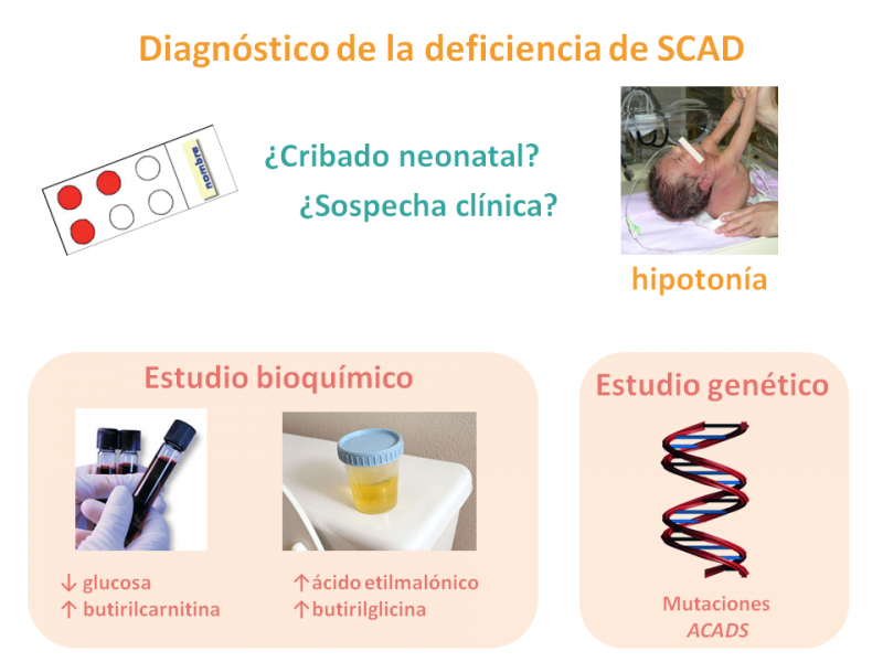 Diagnóstico de la SCAD