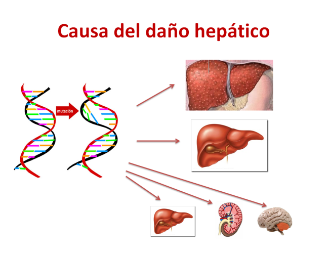 Causa del daño hepático. Imagen: HSJDBCN