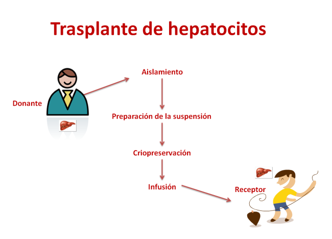  Trasplante de hepatocitos. Imagen: HSJDBCN