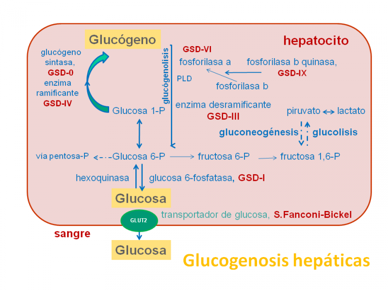 Glucogenosis hepáticas. Imagen: HSJDBCN