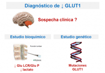 Diagnóstico de GLUT1