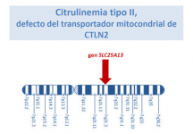 Citrulinemia tipo II