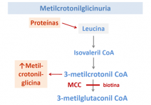 Metilcrotonilglicinuria