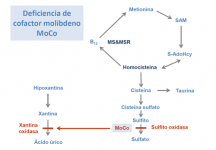 Deficiencia de sulfito oxidasa o cofactor de molibdeno (MoCo)
