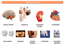 ¿Qué síntomas produce el síndrome de SLO?
