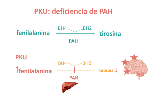 PKU: deficiencia de PAH