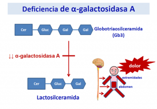 ¿Qué ocurre cuando se produce una deficiencia de α-galactosidasa A?