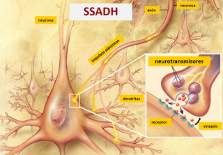 ¿Qué es la deficiencia de succínico semialdehido deshidrogenasa (SSADH)? 