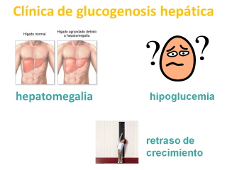 Clínica de las glucogenosis hepáticas. Imagen: HSJDBCN