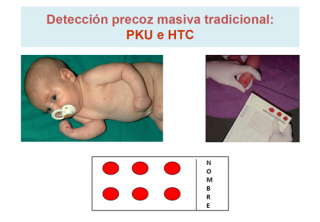 Detección precoz neonatal