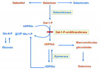 ¿Qué ocurre en las galactosemias?