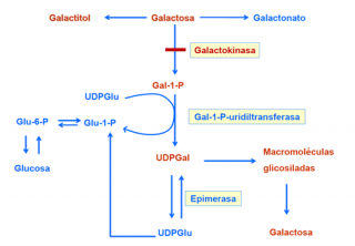 Deficiencia de galactokinasa (GALK)