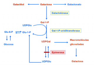 Deficiencia de galactosa-4-epimerasa (GALE)