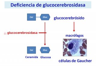 Deficiencia de glucocerebrosidasa