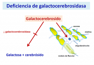 ¿Qué ocurre cuando hay una deficiencia de galactosilcerebrosidasa? 