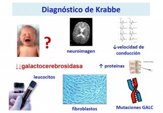 ¿Cómo se diagnostica un paciente con enfermedad de Krabbe? 