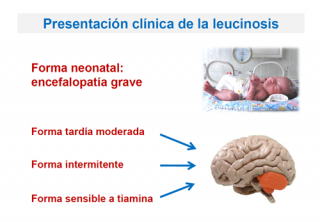 Presentación clínica de las leucinosis