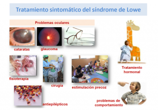 ¿Qué tratamiento se puede realizar en el síndrome de Lowe?