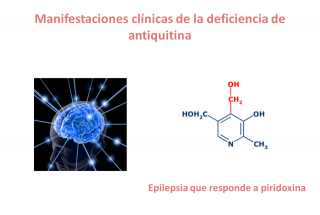 Manifestaciones clínicas de la deficiencia de antiquitina. Imagen: HSJDBCN