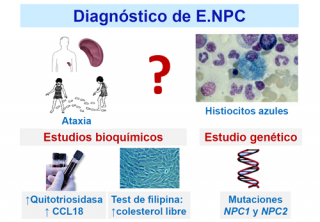 ¿Cómo se diagnostica la enfermedad de NPC?