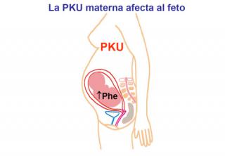 La PKUm afecta al feto