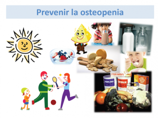 Prevención de la osteopenia