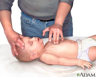 Reanimación cardiopulmonar a un bebé. Imagen: ADAM