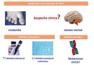 ¿Cómo se diagnostica el síndrome de SLO?