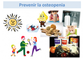 Prevención de la osteopenia