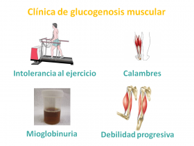 Clínica de las glucogenosis musculares. Imagen: HSJDBCN