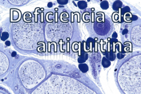 Deficiencia de antiquitina