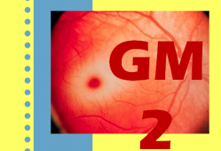 Gangliosidosis GM2