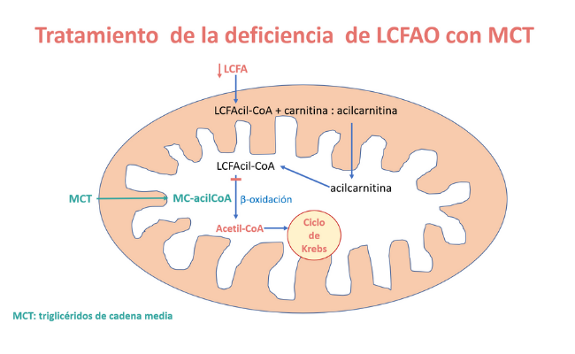 Tratamiento clásico de la deficiencia de LCFAO. Guía Metabólica. Hospital Sant Joan de Déu Barcelona