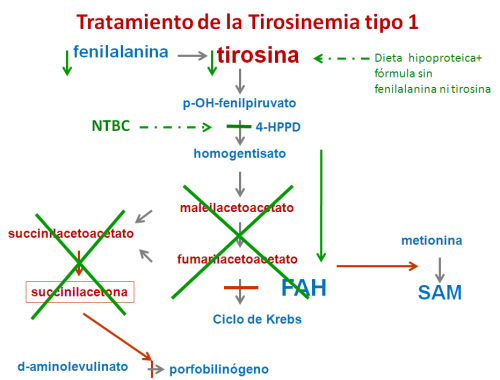 Tratamiento de la Tirosinemia tipo 1