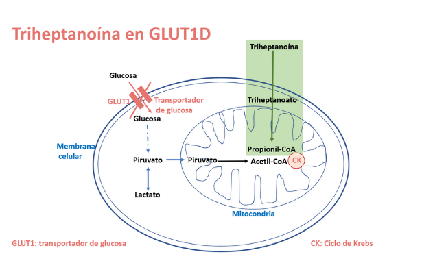 La triheptanoína en el defecto del transportador de glucosa GLUT1